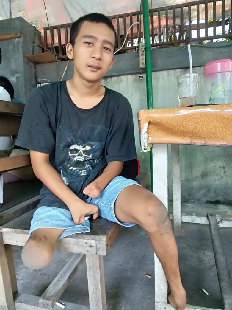 Jualan Jipang, Cara Anak Disabilitas Ini Bertahan Hidup